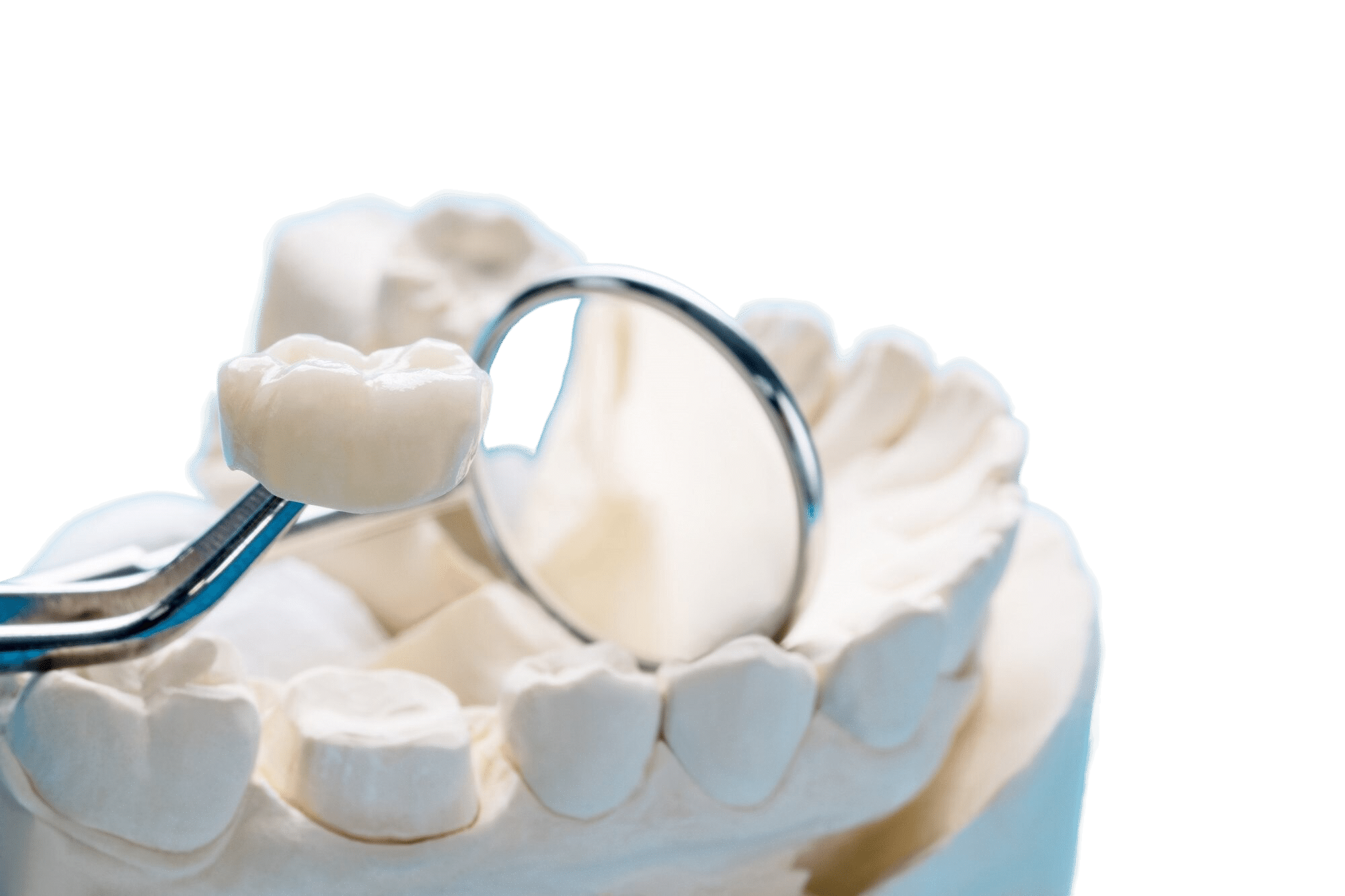What Should You Expect When You Get a Dental Crown?