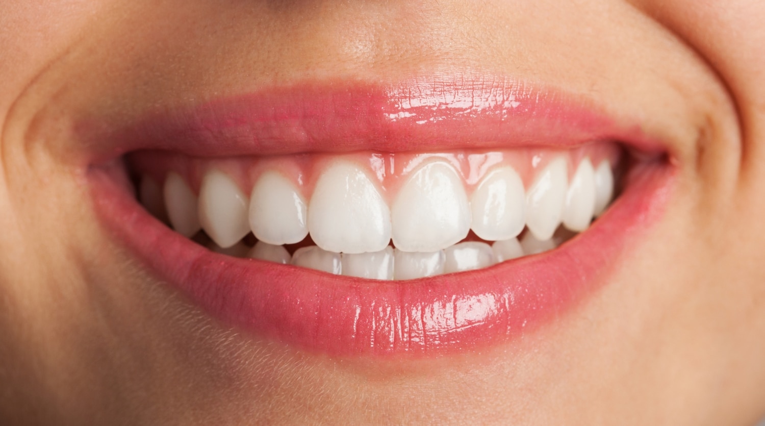 The Science Behind Professional Teeth Whitening