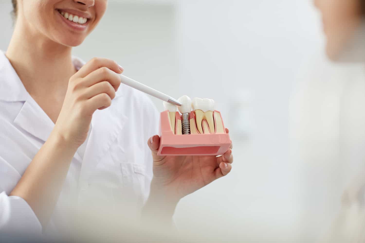 What’s The Timeline for a Dental Implant?