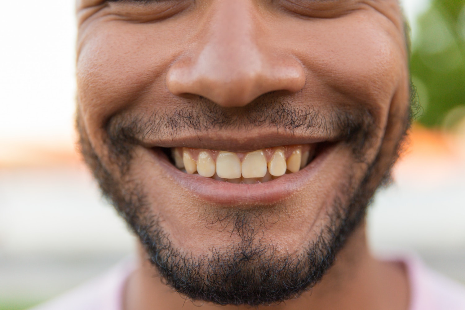 Are There Times When Whitening Isn’t Possible?