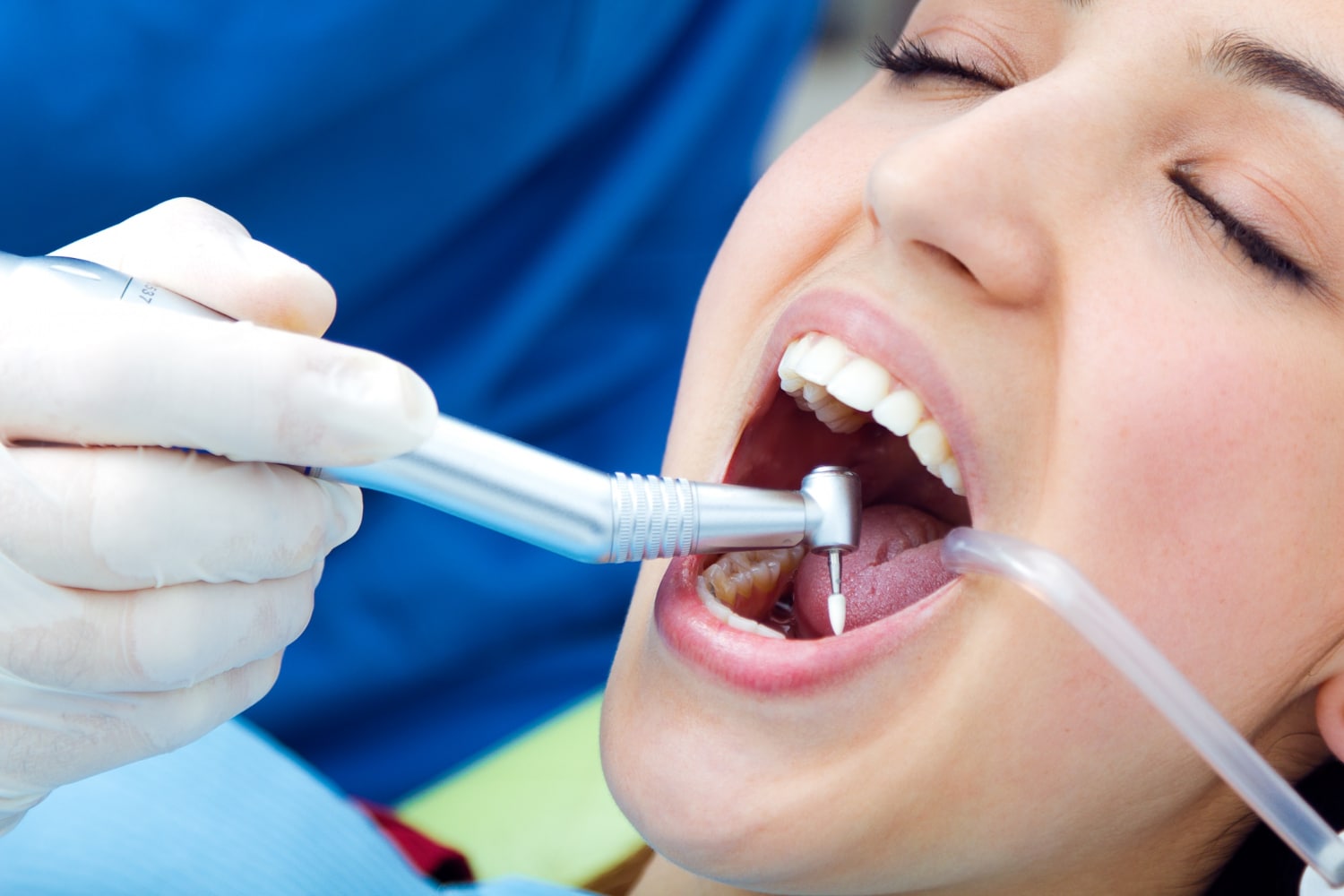 Does Teeth Whitening Always Work?